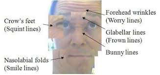 Physically-Based Facial Modelling and Animation including Wrinkles using  the Finite Element Method