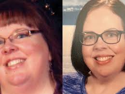 Fundraiser by Sherrie Marlow : Aid for Post-Weight Loss Skin Surgery
