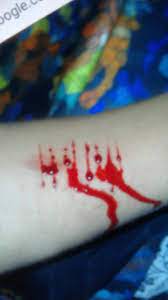 Ari menonjok kaca pada pintu musala dengan tangan kosong sehingga tangannya terluka dan bercucuran darah. 71 Ide Darah Di 2021 Darah Fotografi Arsitektur Rumah Sakit