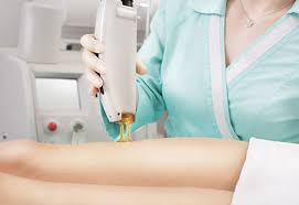 Laser hair removal has become well established as an effective form of treatment for unwanted body hair. Laser Hair Removal Glossary Body Beautiful Laser Medi Spa