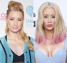 Résultat de recherche d'images pour "breast implant before and after"