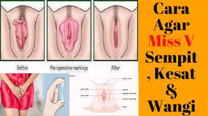 Cara bikin keset miss v wangi, rapet, singset masalah wanita untuk memuasakan suami adalah dengan cara merawat organ intimnya agar selalu keset wangi dan terhindar dari bau tak sedap. Cara Agar Miss V Kesat Dan Rapat Youtube