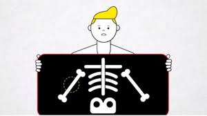 Have been diagnosed with or are waiting for a diagnosis of; . The Most Common Pre Existing Medical Conditions Cnn