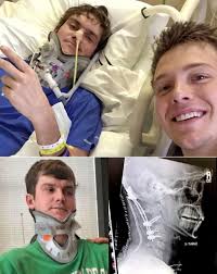 Surviving internal decapitation with stillness