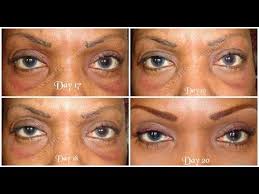 Pin On Exercises Or Surgery Lift And Tone Your Butt And Thighs