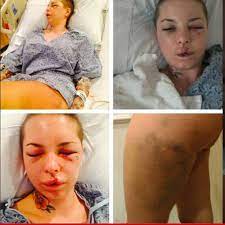 Christy Mack -- War Machine Almost Killed Me ... 18 Broken Bones, Ruptured  Liver