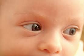 Horner S Syndrome Medical Malpractice Lawyers New York