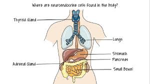 Despite all these efforts it can be unpredictable and spread. How Irrfan Khan Died Of A Neuroendocrine Tumour What Is It Symptoms And Treatment