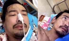 Theo xác nhận của gia đình, ca sĩ việt quang đang điều trị bệnh viêm phổi, nằm tại bệnh viện bệnh nhiệt đới. Ca SÄ© Viá»‡t Quang Bá»‹ Viem Phá»•i Náº·ng Ä'ang Ä'iá»u Trá»‹ Tich Cá»±c