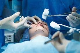 أضرار عمليات التجميل- طبيب يوضح كيفية تجنبها | الكونسلتو