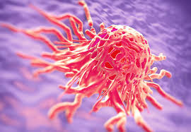 These may look like large, cauliflower growths, which bleed easily on touch (friable). Genes Associated With Increased Risk Of Cervical Cancer Identified Imperial News Imperial College London