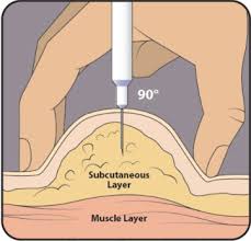 Image result for Subcutaneous Injection