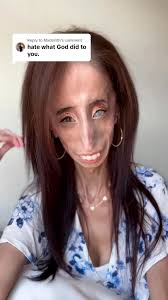 The Mystery of Lizzy Velasquez Unveiled