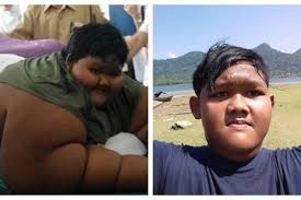 Aneh unik tuesday, june 24, 2014. Ingat Aria Permana Anak Paling Gemuk Di Dunia Penampilannya Kini Semakin Kurus Semua Halaman Nakita