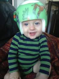 Why My Baby Wore A Helmet For 7 Months Baby Wearing Kylie Jenner Baby
