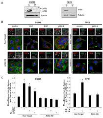 Share photos and videos, send messages and get updates. The Arf Like Gtpase Arl8b Is Essential For Three Dimensional Invasive Growth Of Prostate Cancer In Vitro And Xenograft Formation And Growth In Vivo Oncotarget