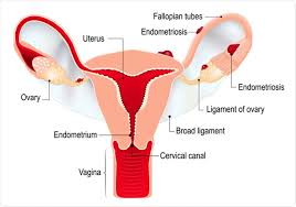 Endometriosis is characterised by the growth of endometrial tissue. Chronic Pain The 20 Most Painful Conditions
