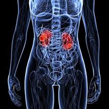 Pin On Renal Cancer
