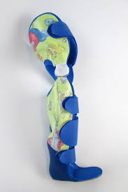 Spitzfuss Orthese Fusse Oberschenkel Schenkel