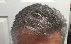 Silk essentials thermal strengthening serum. Men S Non Surgical Custom Hair Systems By Beverly Hills Hair Design In Beverly Hills Ca Alignable