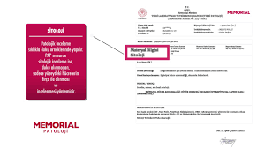 Miyofasyal sendromun lokalizasyonundan bağımsız olarak, servikal, lomber, yüz veya diğer patolojiler doğada nörolojiktir. Fibromiyalji Ve Miyofasiyal Agri Sendromu Mas Nedir Youtube