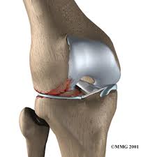 Meniscus Injuries Of The Knee Shoulder Made Simple