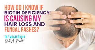 So it's not a general hair loss. How Do I Know If Biotin Deficiency Is Causing My Hair Loss And Fungal Rashes Masterjohn Q A Files 176