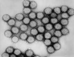 Rotavirus commonly causes severe, watery diarrhea the most common symptoms of rotavirus are severe watery diarrhea, vomiting, fever, and/or abdominal pain. Humane Rotaviren Wikipedia
