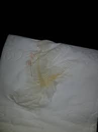 Wenn sie den abgang des pfropfes etwa zum zeitpunkt ihres errechneten geburtstermins beobachten, ohne jedoch einen blasensprung bzw. 32 Best Pictures Schleimpfropf Abgegangen Wann Geburt Geburt Wann In Die Klinik Die Besten Bucher Bei Amazon Itoomirtsyz