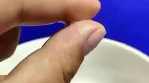 Sifat inilah yang mampu menghilangkan jerawat secara ampuh di punggung. Letakkan Garam Cara Nak Menghilangkan Gam Gajah Dari Tangan Youtube