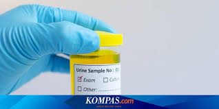 Air kencing warna putih apakah sehat. 11 Warna Urine Dan Artinya Pada Kesehatan Anda Halaman All Kompas Com
