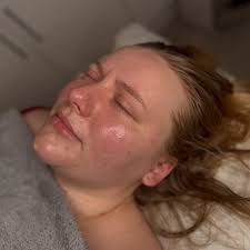 Our gorgeous bride-to-be @shannon_hodgkiss is undergoing a fully bespoke,  medically led skin optimisation programme ✨ This journey is centred around  skin health restoration and enhancement, using evidence-based treatments  and medical-grade skincare to