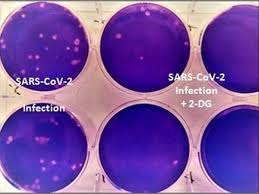 Pdffiller allows users to edit, sign, fill and share all type of documents online. Dcgi Approves Anti Covid Drug Developed By Drdo For Emergency Use Business Standard News