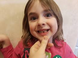 Our Life with 13 Kids * **: Natalie's First Lost Tooth