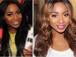Before And After Black And White Bleaching Cream Reviews Hydrogen Peroxide Skin Bleaching Before And Afer Peroxide Hair Bleaching Dark Hair Skin Bleaching