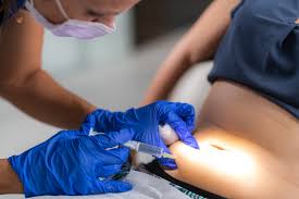 Image result for Subcutaneous Injection