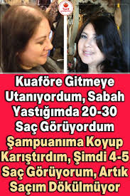 Saciniz Dokuluyorsa Denemelisiniz Hair Loss Growth Hair Loss Natural Hair Loss