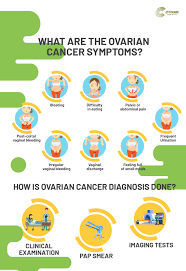 If you're diagnosed with ovarian cancer, it will be given a stage. Ovarian Cancer Symptoms Diagnosis Treatment Cytecare
