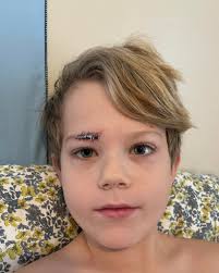 Well, we all have stories of the first time we had to get stitches? I know  I do. My little Nuggy now has a story too. My baby had a freak accident