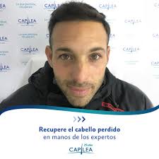 Golazo colombiano! 🇨🇴 Colombia vence 1-0 a Uruguay en las semifinales de  la Copa América. Implante capilar en El Salvador se dice CAPILEA. Recupere  el cabello perdido en manos de los expertos. ¡