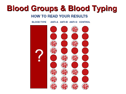 We did not find results for: Blood Typing