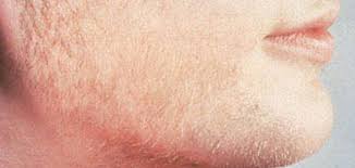 We did not find results for: Ø§Ø¯ÙˆÙŠØ© Ù„Ø²ÙŠØ§Ø¯Ø© Ù‡Ø±Ù…ÙˆÙ† Ø§Ù„Ø°ÙƒÙˆØ±Ø© Ø­ÙŠØ§ØªÙƒ