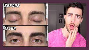 Microblading is the art of applying semi permanent brows to your. My Microblading Experience Youtube