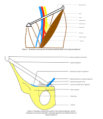 Inguinal ligament, sometimes referred to as poupart. Anatomy Abdomen And Pelvis Inguinal Crural Pouparts Ligament Article
