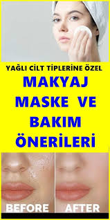 Yagli Cilt Tiplerine Ozel Bakim Onerileri Oily Skin Skin Types Oily