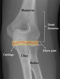 Image result for Humerus Bone