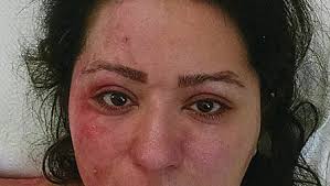 Woman gets 50 years in poisoning