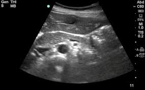 A Sharp Tearing Pain In The Abdomen Emergency Physicians Monthly