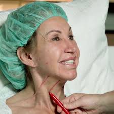 Carmen Geiss' teure Verjüngungskur: Facelifting verschlingt fünfstellige  Summe