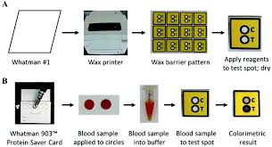 Image result for G6PD Deficiency Detection